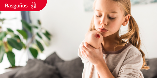 Imagen de una niña con un rasguño en el codo Imagen de una niña con un rasguño en el codo